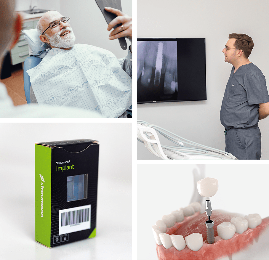 Dental implant illustration